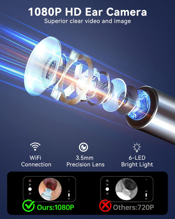 Camera Ear Cleaner