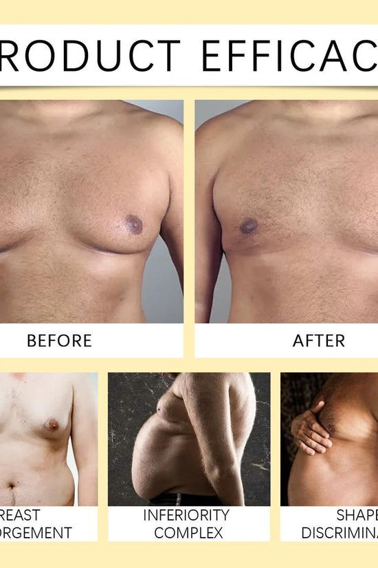 Men Therm Bee Venom Gynecomastia Heating Oil