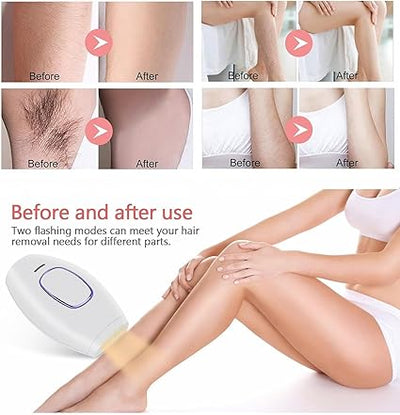 Flashes IPL laser hair Removal