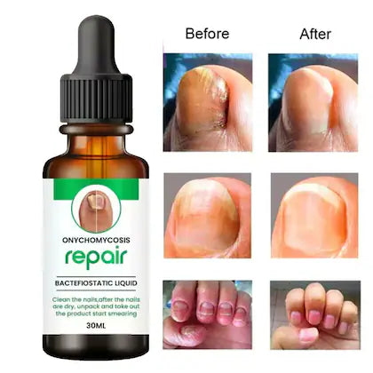 Nail Revive