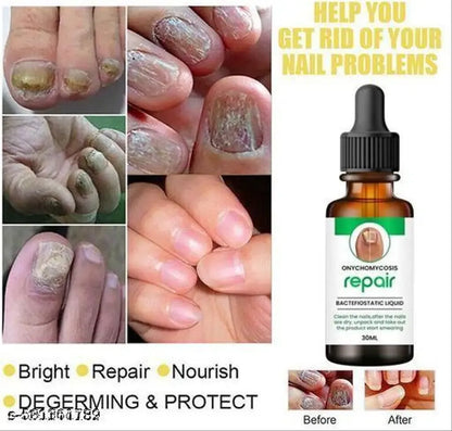 💅Nail Serum for Repair & Growth