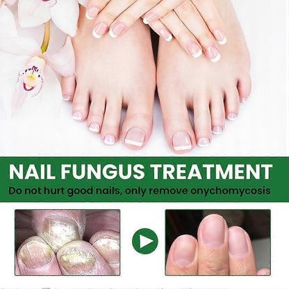 💅Nail Serum for Repair & Growth